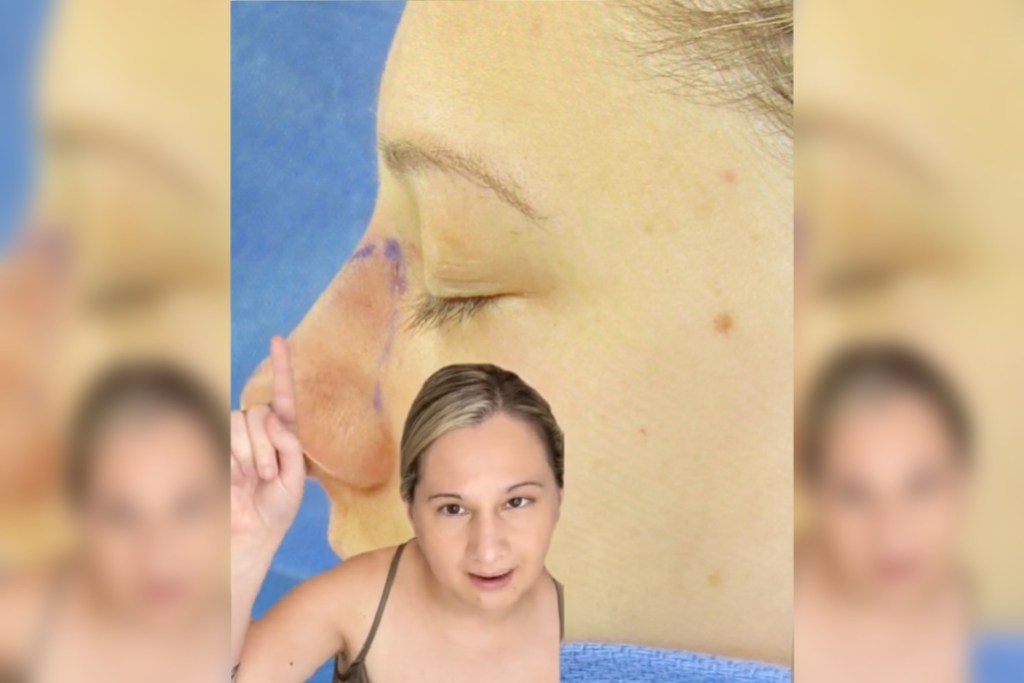 gypsy-rose-blanchard-reveals-post-plastic-surgery-look-recovery-update-i-would-not-change-anything-else