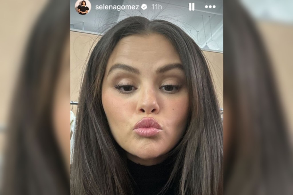 selena-gomez-reveals-the-one-cosmetic-procedure-shes-had-done