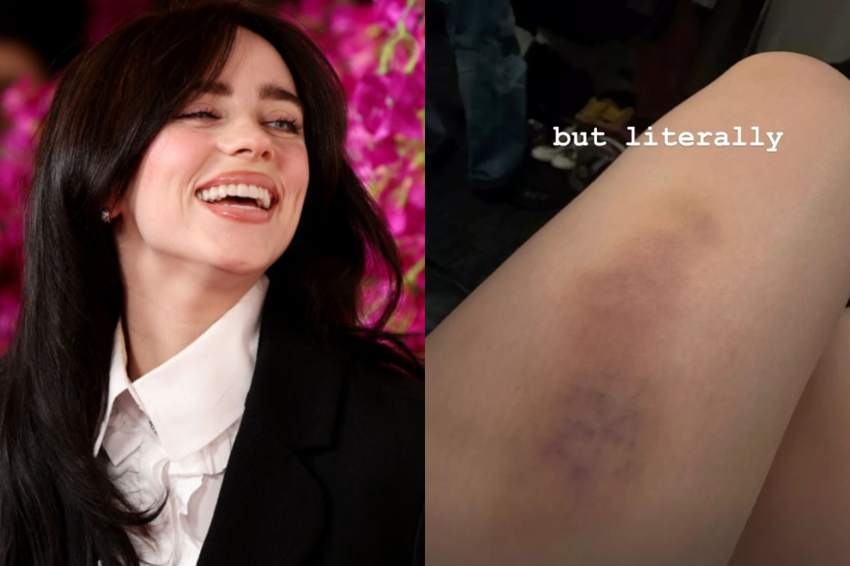 billie-eilish-takes-huge-fall-on-stage-shows-off-injuries-post-concert-on-instagram